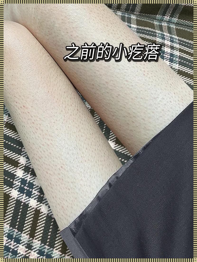 鸡皮肤的逆袭：摆脱粗糙，迎接丝滑