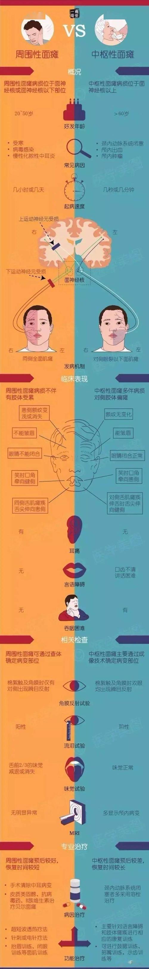 面瘫鉴别手册：笑不出来，就是那么回事